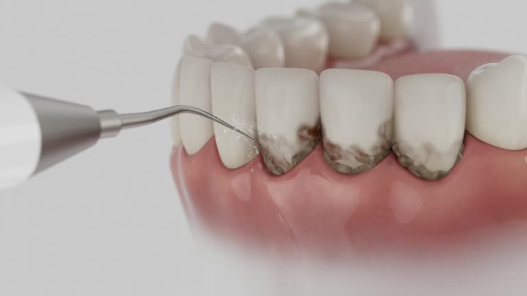 Reliable Teeth Cleaning And Checkup contractor in Carroll County County, MS by Dentist Open Now